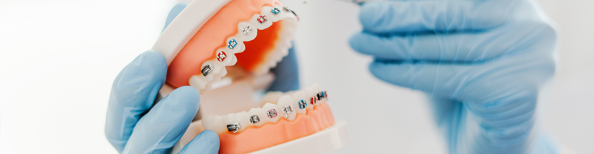 gloved hands holding mouth model with braces